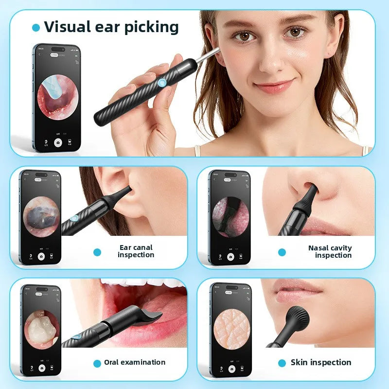 Wireless Ear Cleaning Camera – Rechargeable HD Ear Wax Removal Tool with LED Light & Silicone Tips